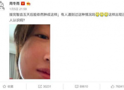 娱乐圈吃瓜爆料周冬雨